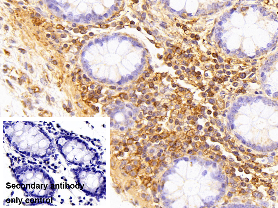 Polyclonal Antibody to Monoamine Oxidase A (MAOA)