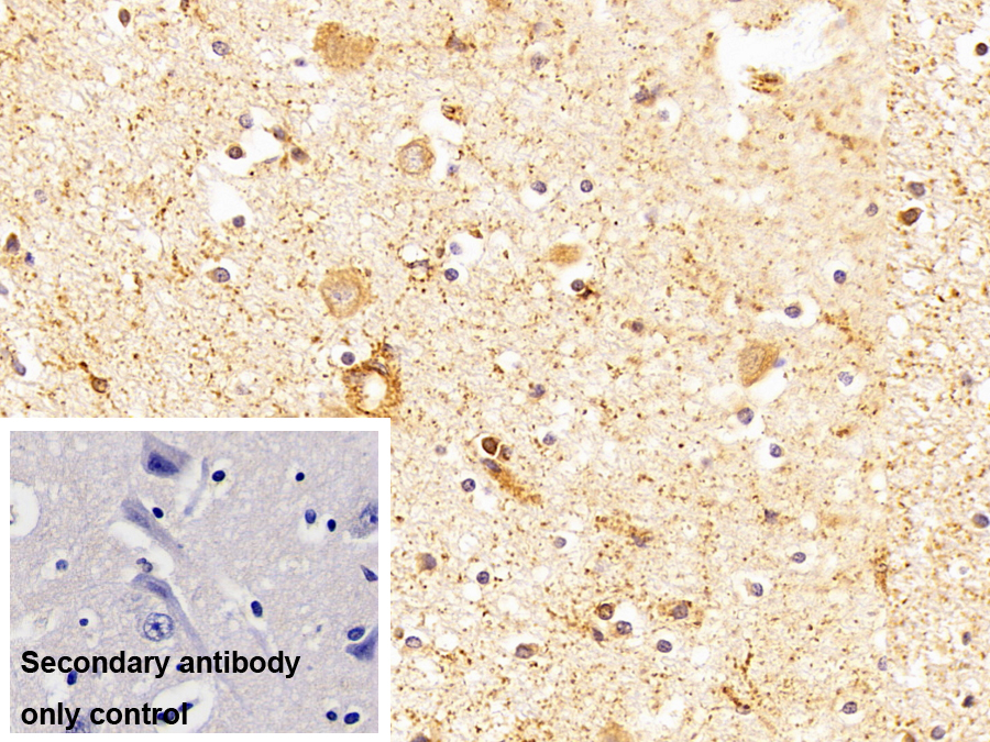 Polyclonal Antibody to Monoamine Oxidase A (MAOA)