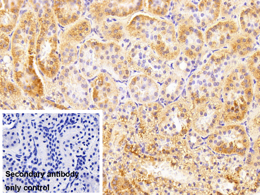 Polyclonal Antibody to Monoamine Oxidase A (MAOA)