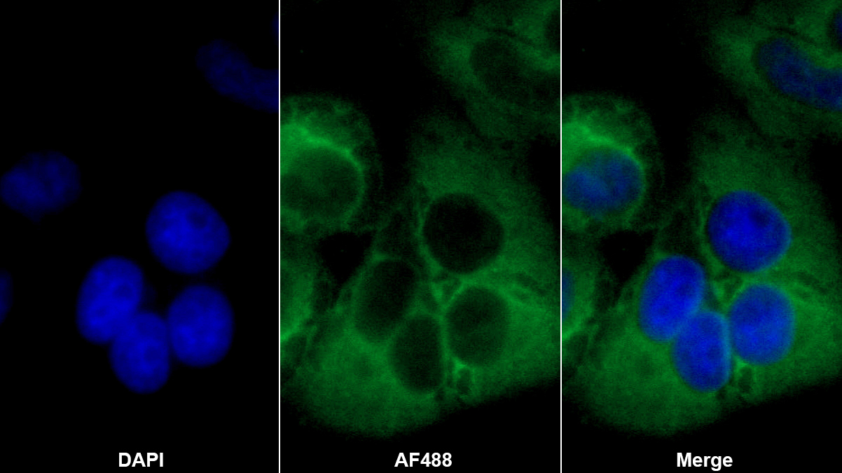 Polyclonal Antibody to Calpain 1 (CAPN1)