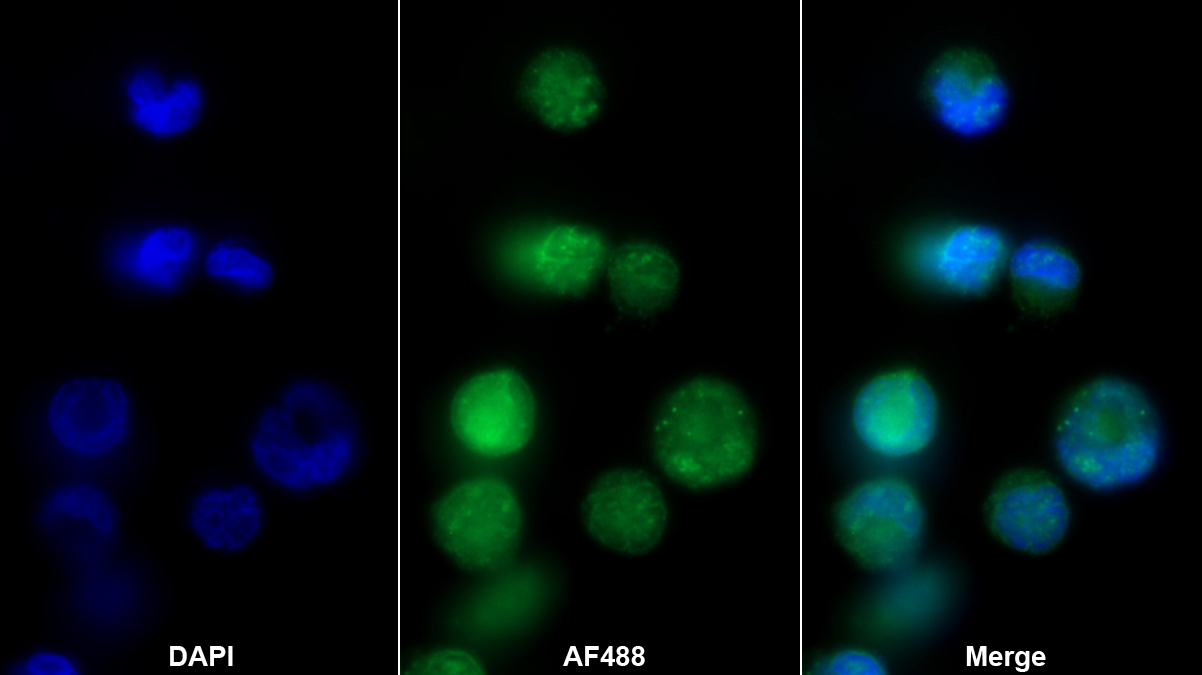 Polyclonal Antibody to Protein S (PROS)