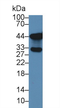 Polyclonal Antibody to Sodium Hydrogen Exchange Regulatory Cofactor 2 (SLC9A3R2)