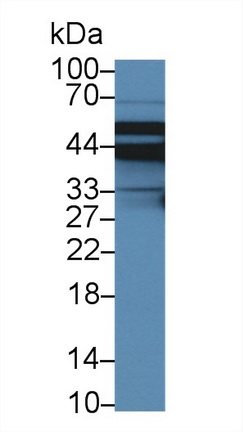 Polyclonal Antibody to Sodium Hydrogen Exchange Regulatory Cofactor 2 (SLC9A3R2)