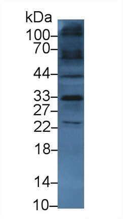 Polyclonal Antibody to Sodium Hydrogen Exchange Regulatory Cofactor 2 (SLC9A3R2)