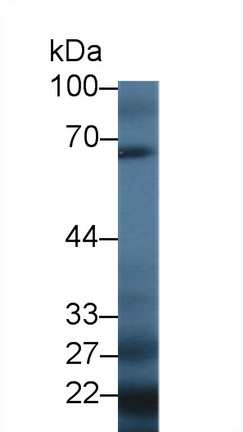 Polyclonal Antibody to Complement Factor I (CFI)