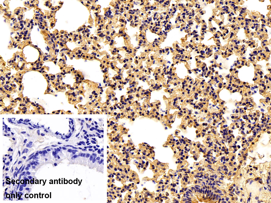 Polyclonal Antibody to Complement Factor I (CFI)