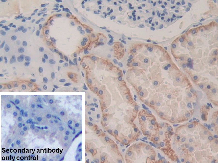Polyclonal Antibody to Cadherin 16 (CDH16)