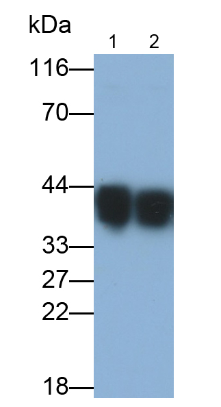 Polyclonal Antibody to Haptoglobin Related Protein (HPR)