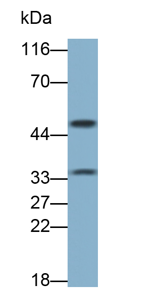 Polyclonal Antibody to Haptoglobin Related Protein (HPR)