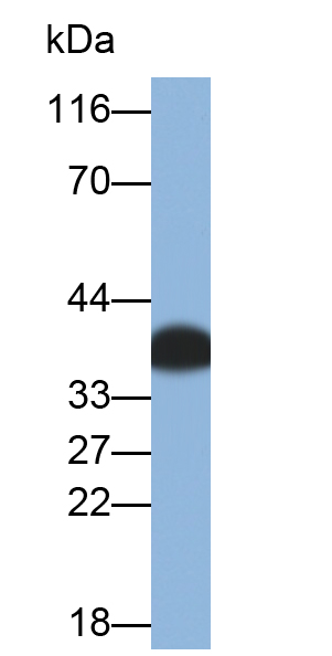 Polyclonal Antibody to Large Neutral Amino Acid Transporter 1 (LAT1)