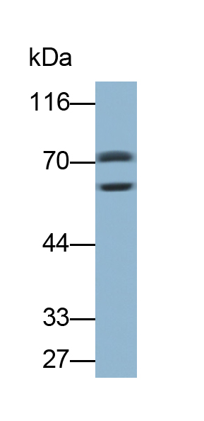 Polyclonal Antibody to Serpin A10 (SERPINA10)