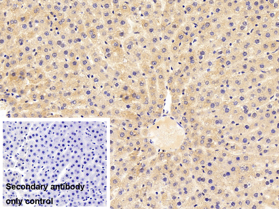 Polyclonal Antibody to Complement Factor B (CFB)