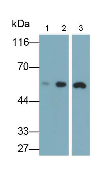 Polyclonal Antibody to Cytokeratin 8 (CK8)