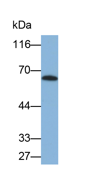 Polyclonal Antibody to Cytokeratin 8 (CK8)