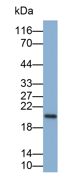 Polyclonal Antibody to O-6-Methylguanine DNA Methyltransferase (MGMT)