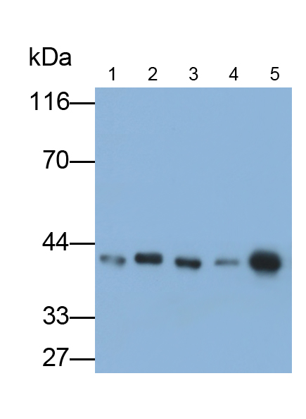 Polyclonal Antibody to Creatine Kinase B (CK-BB)