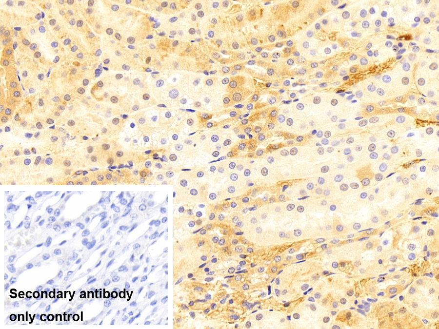 Polyclonal Antibody to Transferrin (TF)