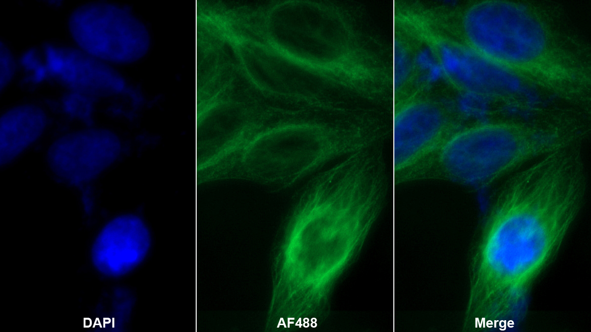 Polyclonal Antibody to Transferrin (TF)