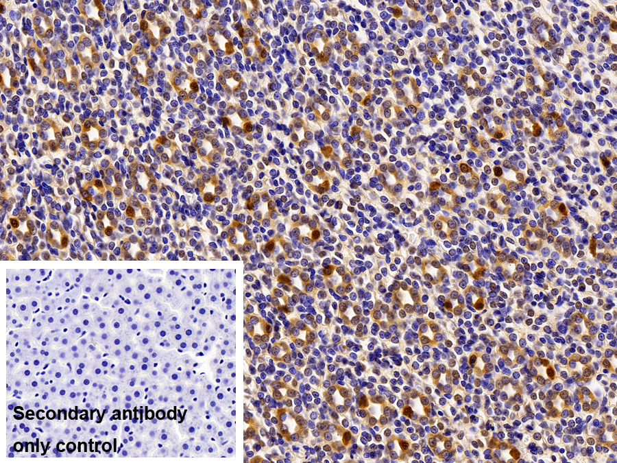 Polyclonal Antibody to Farnesoid X Receptor (FXR)