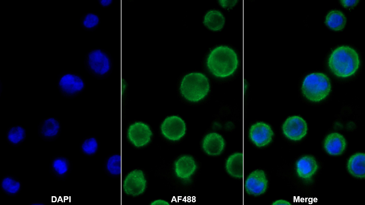 Polyclonal Antibody to Phospholipase B (PLB)