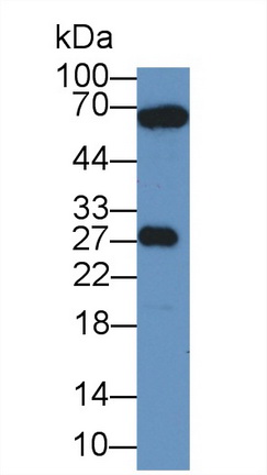 Polyclonal Antibody to High Mobility Group Box Protein 2 (HMGB2)