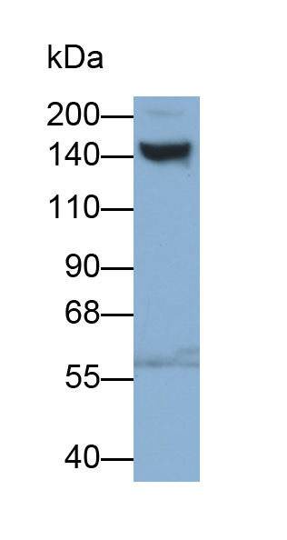 Polyclonal Antibody to Platelet Derived Growth Factor Receptor Alpha (PDGFRa)