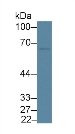 Polyclonal Antibody to Fibroblast Growth Factor Receptor Substrate 2 (FRS2)