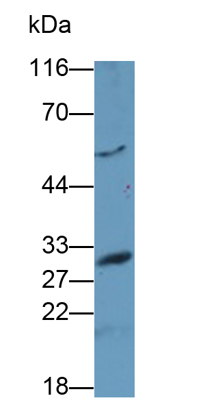 Polyclonal Antibody to Asialoglycoprotein Receptor 2 (ASGR2)