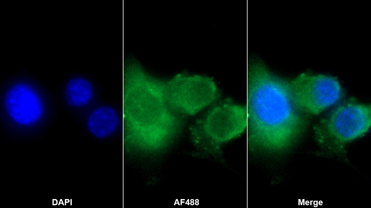 Polyclonal Antibody to Macrophage Inflammatory Protein 1 Gamma (MIP1g)