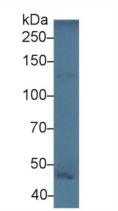 Polyclonal Antibody to Laminin Beta 3 (LAMb3)