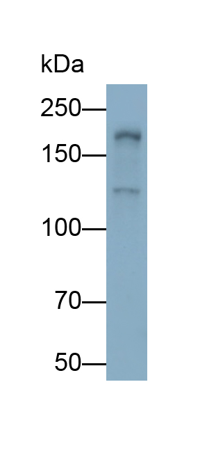 Polyclonal Antibody to Laminin Gamma 3 (LAMC3)