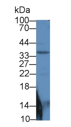 Polyclonal Antibody to SMAD family member 6 (SMAD6)