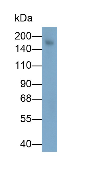 Polyclonal Antibody to Collagen Type XVII (COL17)