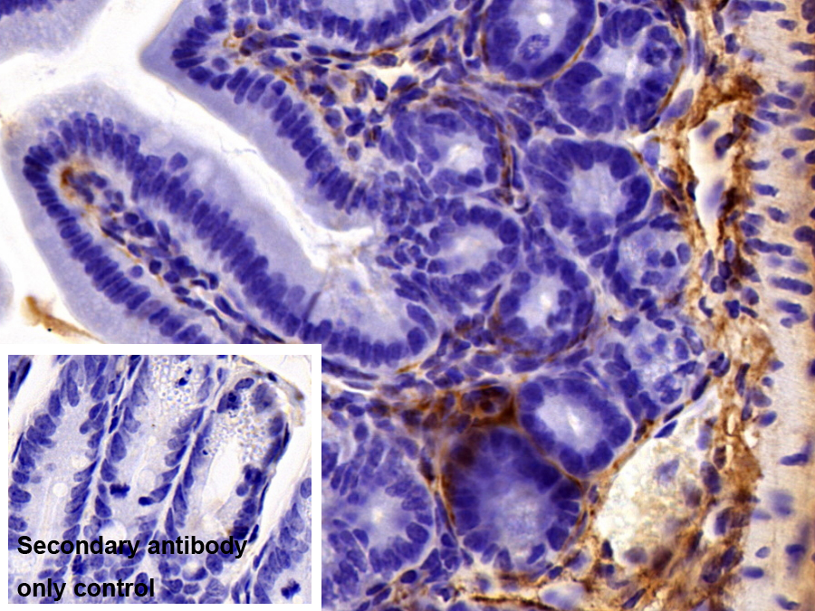 Polyclonal Antibody to Collagen Type VI Alpha 1 (COL6a1)