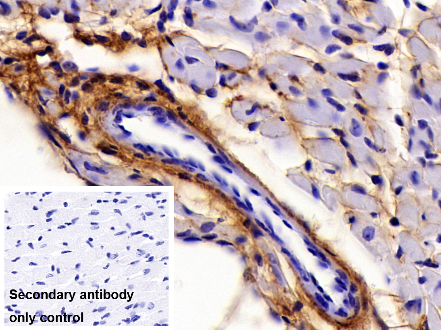 Polyclonal Antibody to Collagen Type VI Alpha 1 (COL6a1)