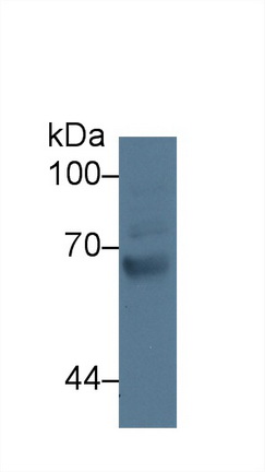 Polyclonal Antibody to G Protein Coupled Receptor Kinase 4 (GRK4)