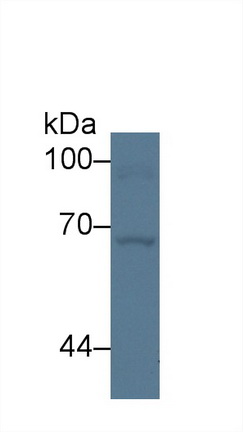 Polyclonal Antibody to G Protein Coupled Receptor Kinase 4 (GRK4)