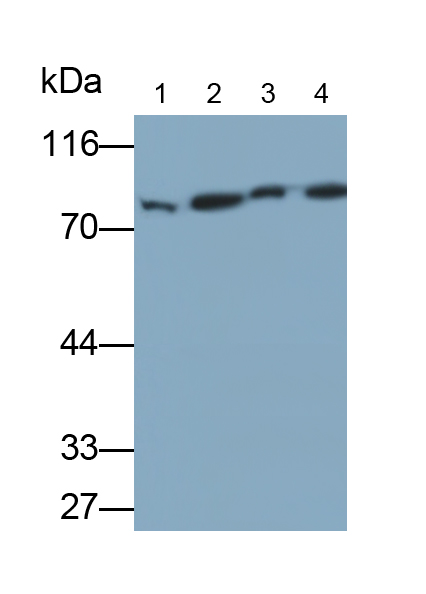 Polyclonal Antibody to Junction Plakoglobin (JUP)