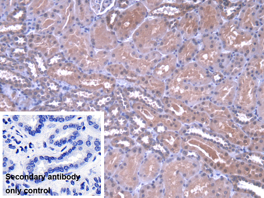 Polyclonal Antibody to Protein Phosphatase 1, Catalytic Subunit Alpha Isoform (PPP1Ca)