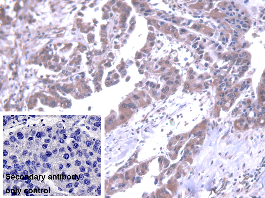 Polyclonal Antibody to Protein Phosphatase 1, Catalytic Subunit Alpha Isoform (PPP1Ca)