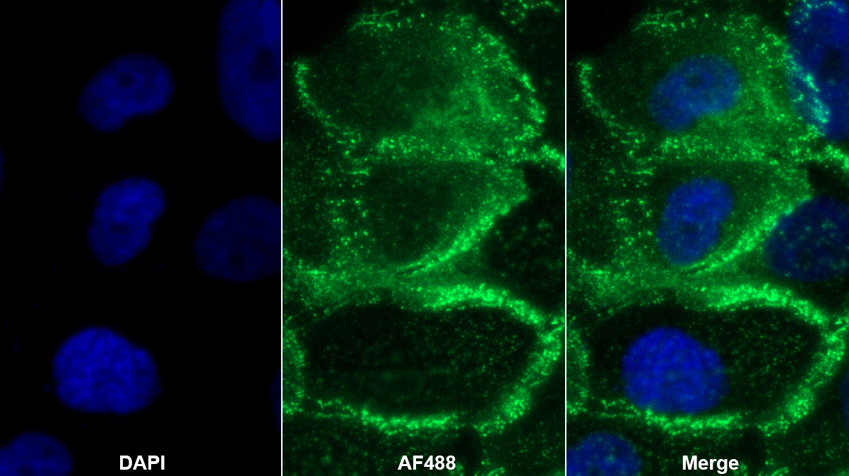 Polyclonal Antibody to Desmoglein 2 (DSG2)