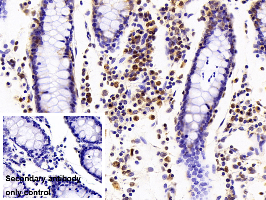 Polyclonal Antibody to Histone Deacetylase 2 (HDAC2)