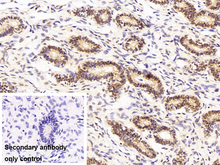 Polyclonal Antibody to Histone Deacetylase 2 (HDAC2)