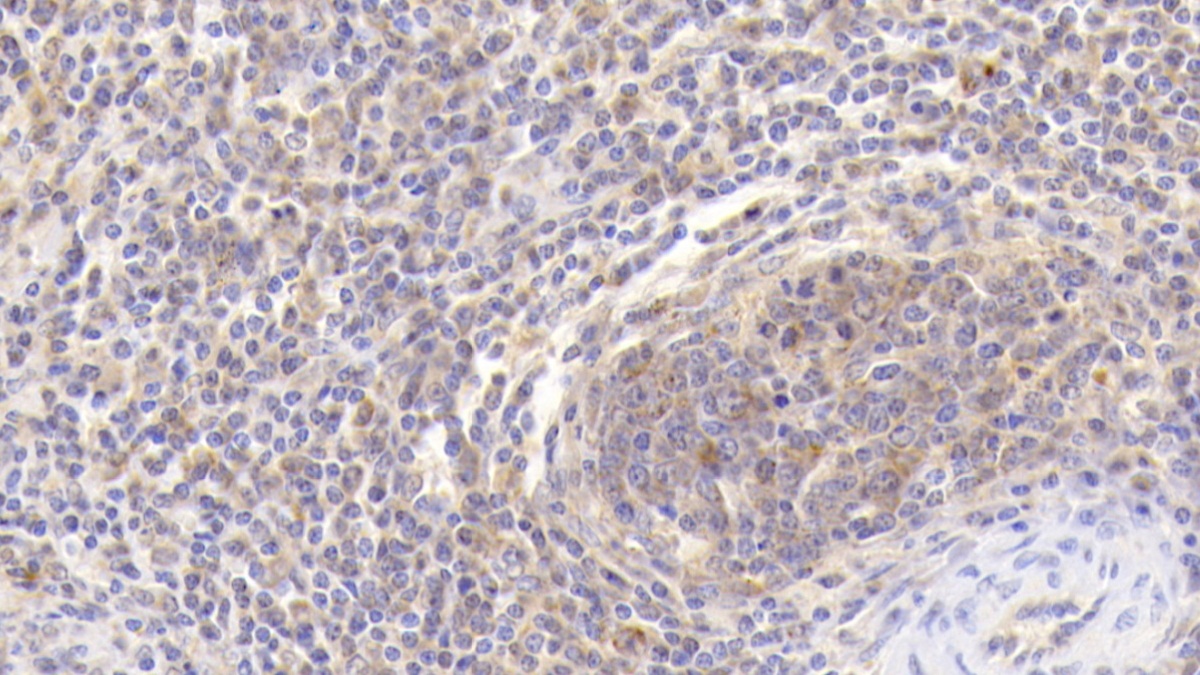 Polyclonal Antibody to Vav 1 Oncogene (VAV1)