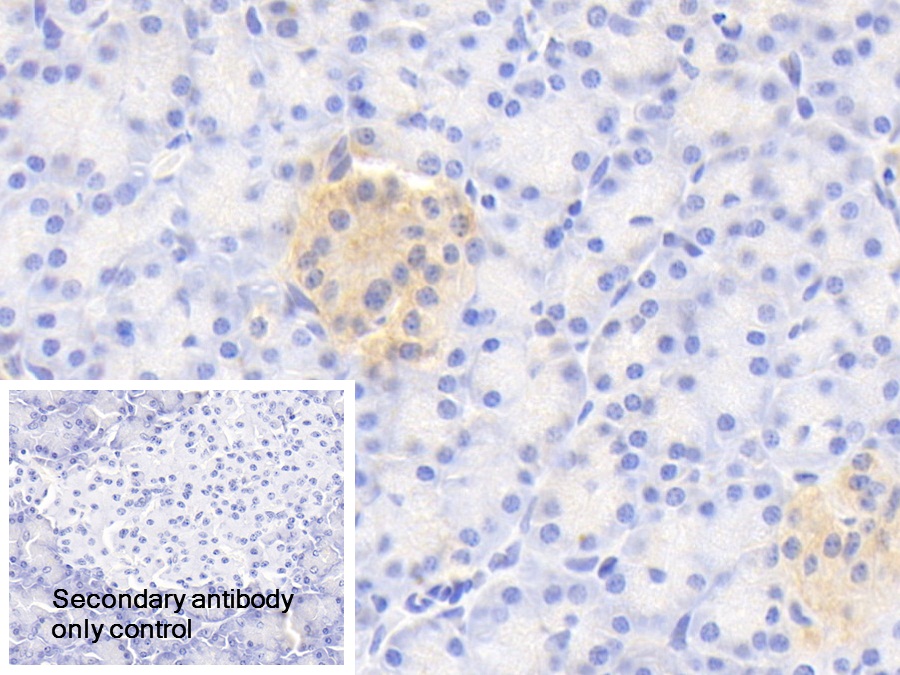 Polyclonal Antibody to G Protein Alpha Z (GNaZ)