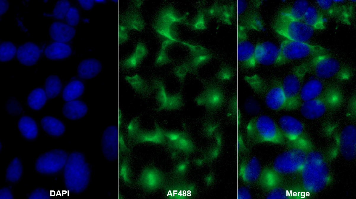 Polyclonal Antibody to G Protein Alpha Z (GNaZ)