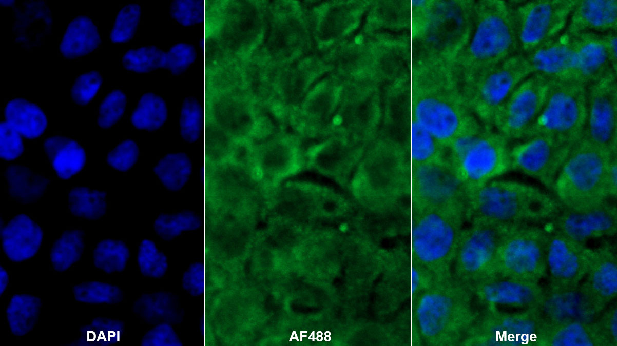 Polyclonal Antibody to Profilin 1 (PFN1)