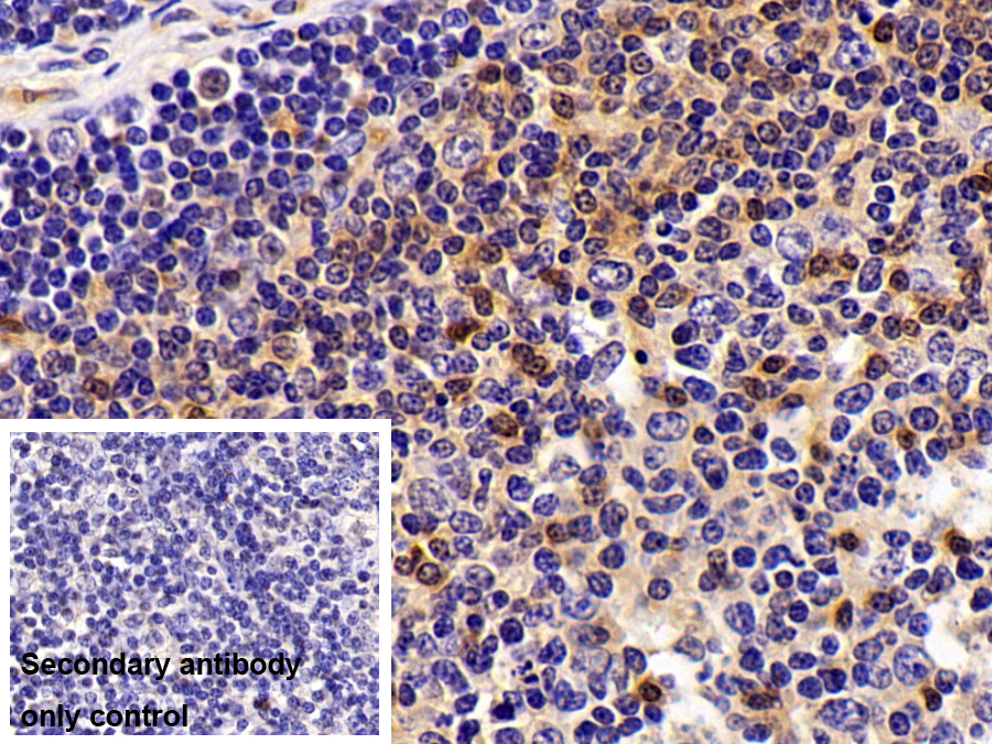 Polyclonal Antibody to Profilin 1 (PFN1)