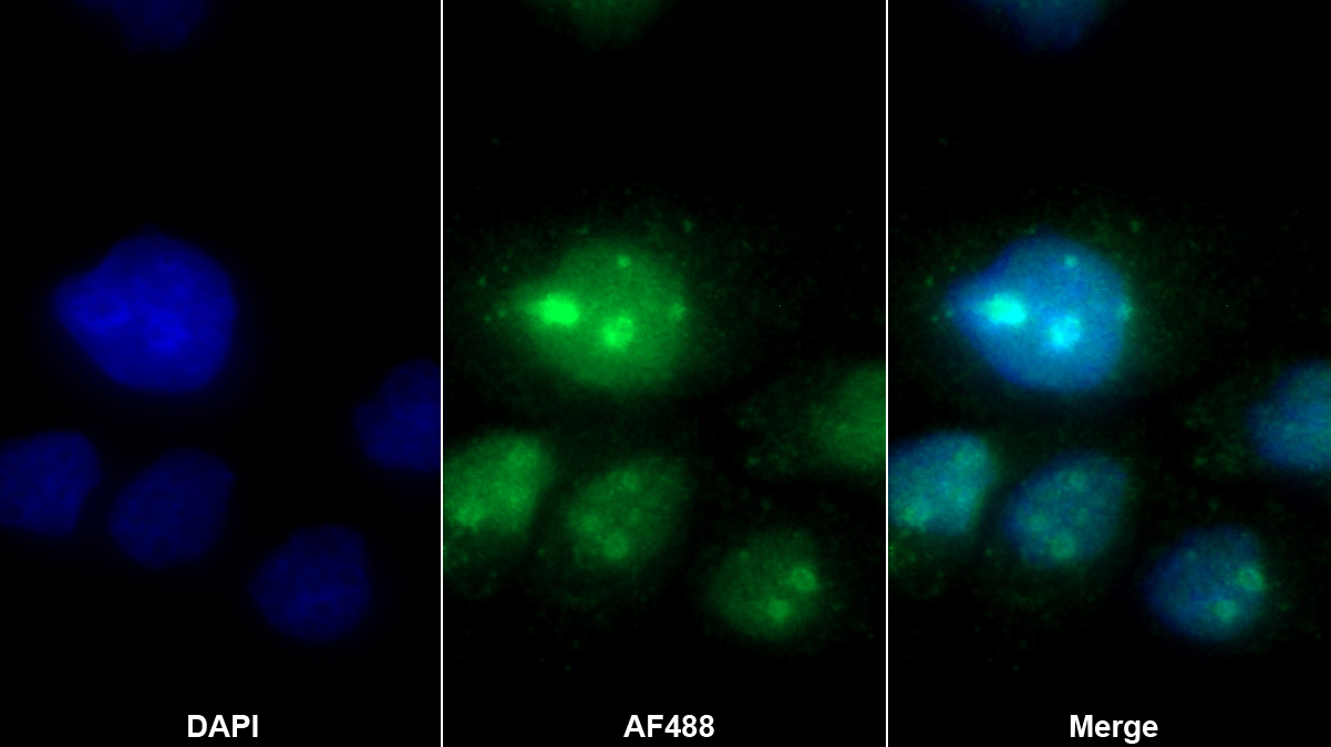 Polyclonal Antibody to Nucleolin (NCL)