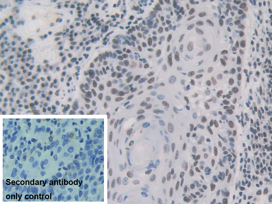 Polyclonal Antibody to Heterogeneous Nuclear Ribonucleoprotein A1 (HNRNPA1)